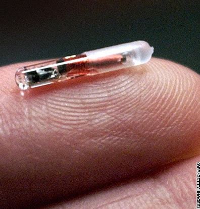 rfid chip human implants|Microchip implant (human) .